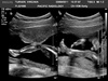 Bean at 20 weeks! Everything looks to be as it should. Two legs, two hands, big brain, a nose!