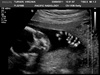 Bean at 20 weeks! Everything looks to be as it should. Two legs, two hands, big brain, a nose!