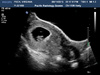 8 week scan! It looks like a ghost baby. We will name it Pixel.