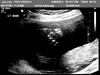 The thumbs up from Pixel saying everything is A-O-K at the 20 week scan. Hard to believe we are halfway there already!