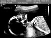 The thumbs up from Pixel saying everything is A-O-K at the 20 week scan. Hard to believe we are halfway there already!