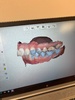 So the orthodontist journey begins…